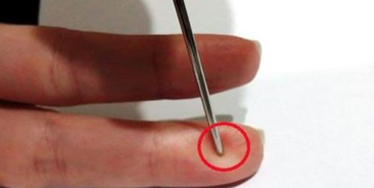 A needle can save a patient’s life from a stroke. This advice is from a Chinese professor who says that we all need to keep a needle or a syringe in the house